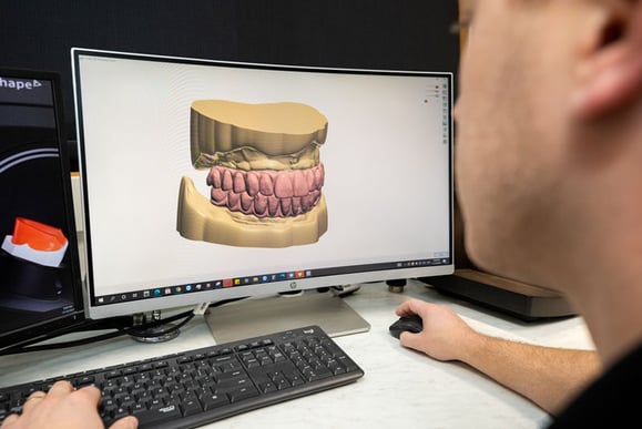 staff looking at 3d model of teeth